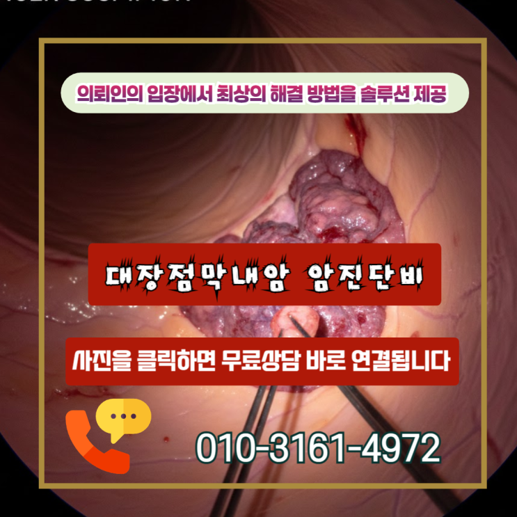  대장점막내암 암진단비 D01.0 코드라도 전액 받을 수 있는 필승 전략