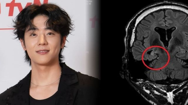  '병역 비리' 없는 청정 구역...배우 채종협, 뇌전증 환우 위해 "5천만원" 쾌척(+5급 전시근로역)