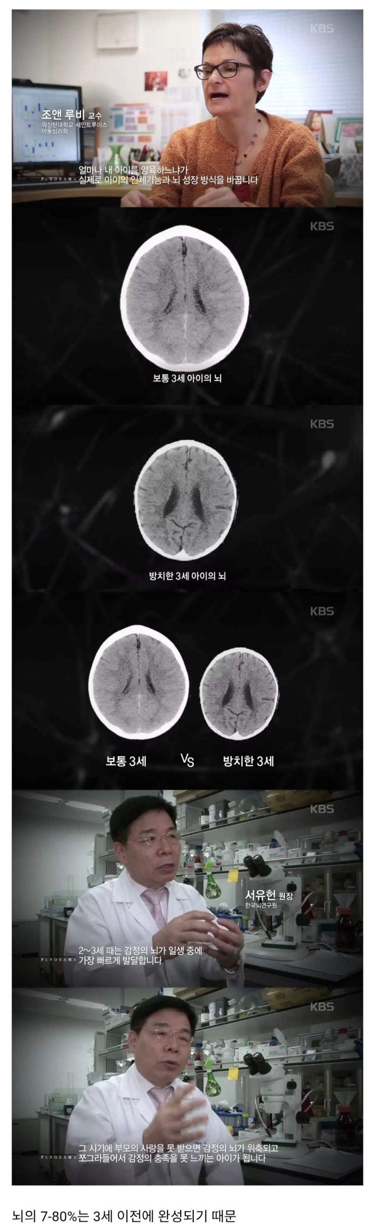  3세 이하 아이를 사랑으로 키워야 하는 이유.jpg