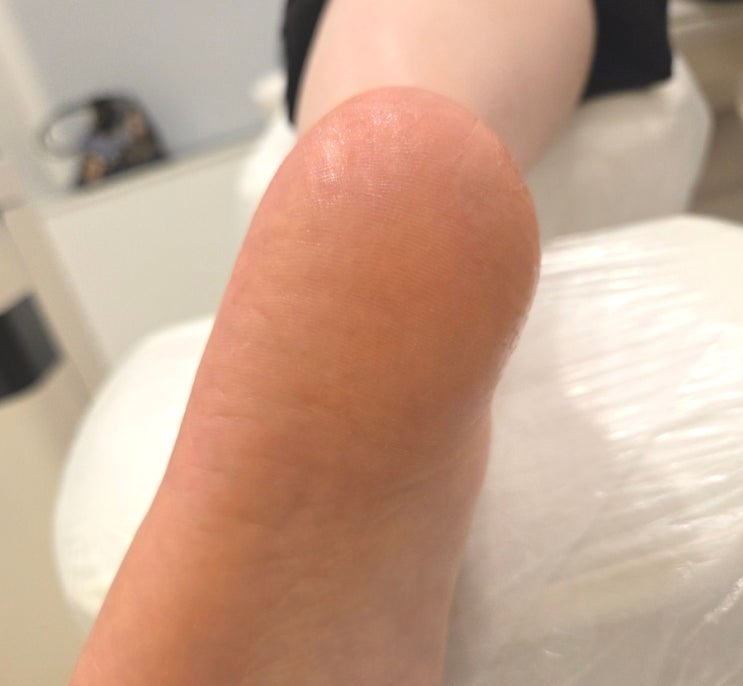  레푸스 분당정자점 정나리 푸스플레게 꼼꼼 만족 후기