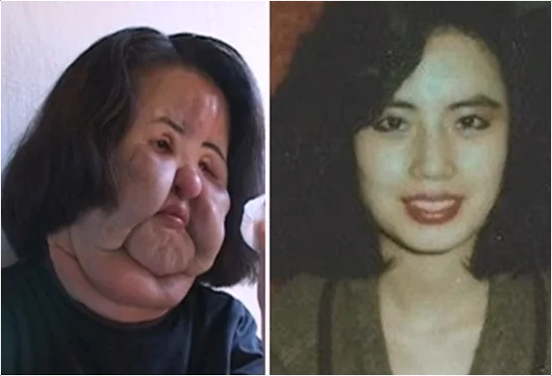  선풍기 아줌마 한혜경 과거 미모와 가수의 꿈 그리고 숨겨진 진실