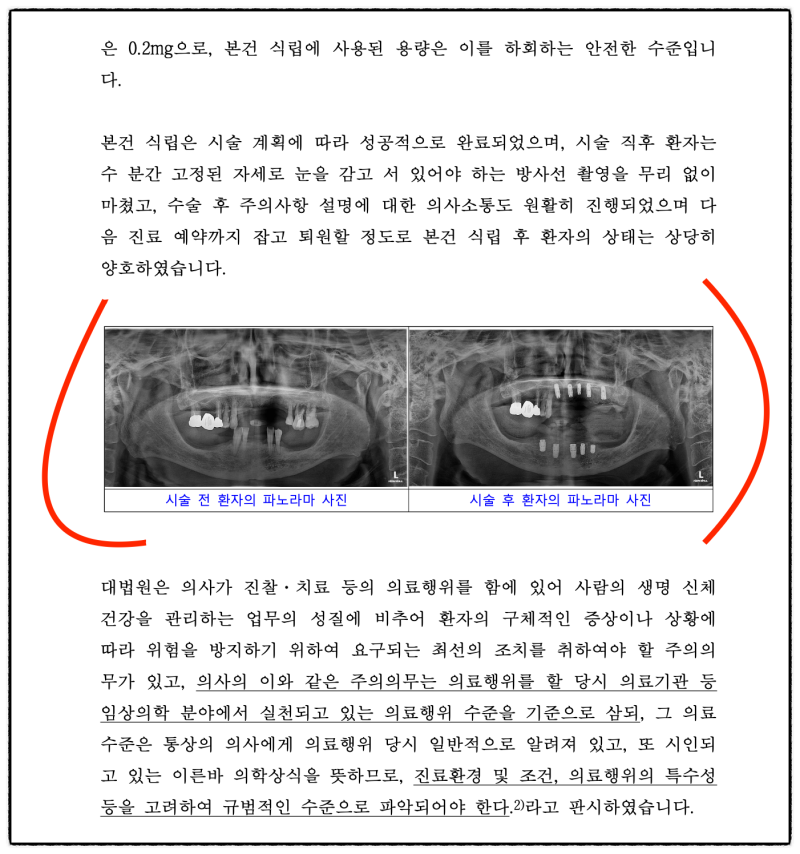 [의료소송 성공사례] 고령의 뇌경색 환자, 무리한 임플란트 시술 후 사망 관련 이미지 5