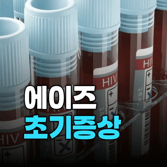  에이즈 초기증상, 의심된다면 증상보다 이걸 먼저 확인하세요