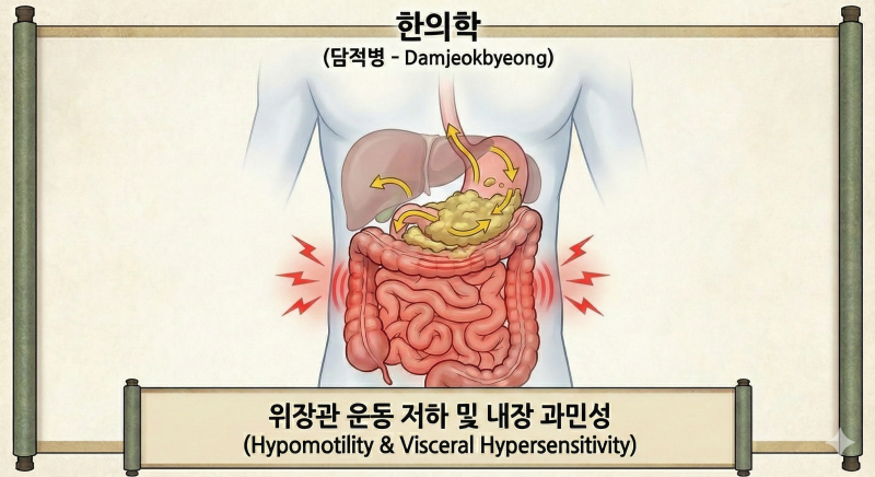 내시경은 '정상'이라는데 왜 계속 아플까요? 위장이 돌처럼 굳는 [담적병]