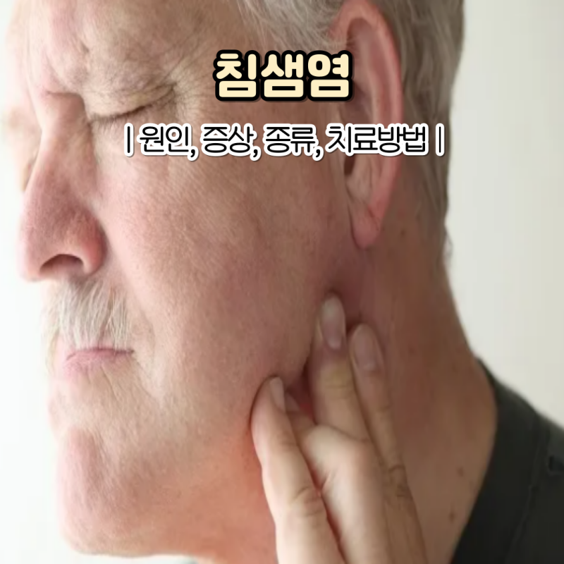 침샘염 증상 원인 침샘염 치료방법은?