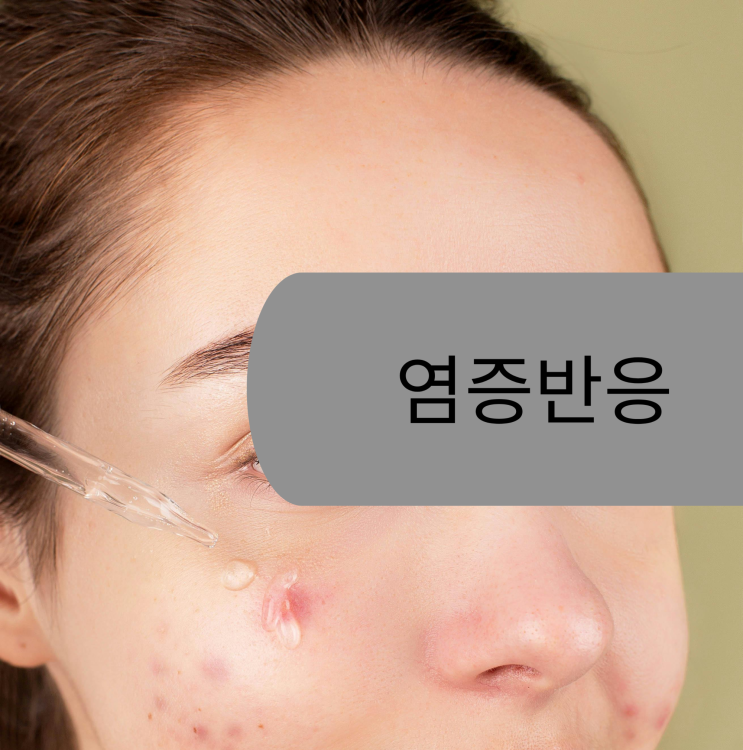  스트레스 피부 트러블 싹-! 수면 부족으로 망가진 피부 되살린 리얼 후기 (2026)