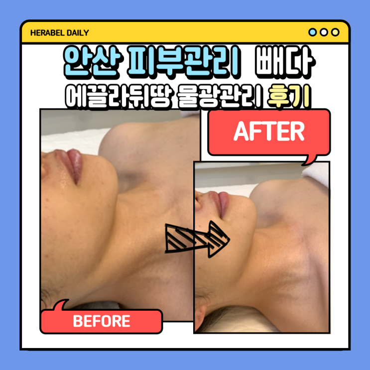  에끌라뒤땅 물광관리 솔직후기 [안산 빼다]에서 단 1회로 탕후루광 피부 완성한 썰