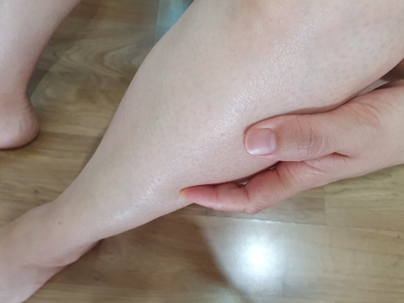 신장염증상 및 급성신장염 원인 이렇게 치료 하세요