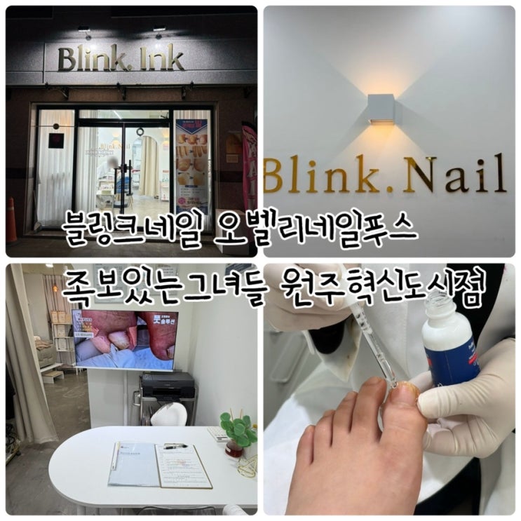  원주네일샵 "블링크네일 오벨리네일푸스 족보있는 그녀들 원주혁신도시점" 문제성 발 케어