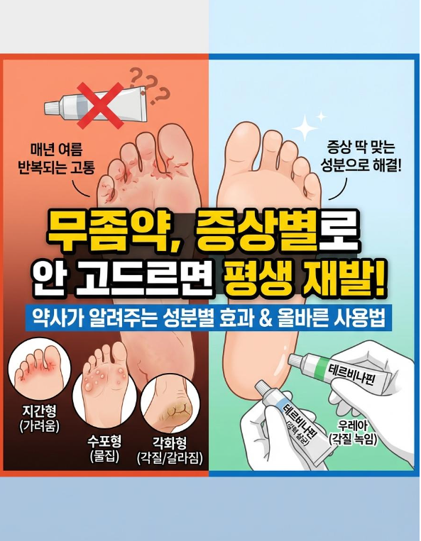 무좀 연고, 증상별로 안 고르면 평생 재발합니다약사가 알려주는 성분별 효과 총정리