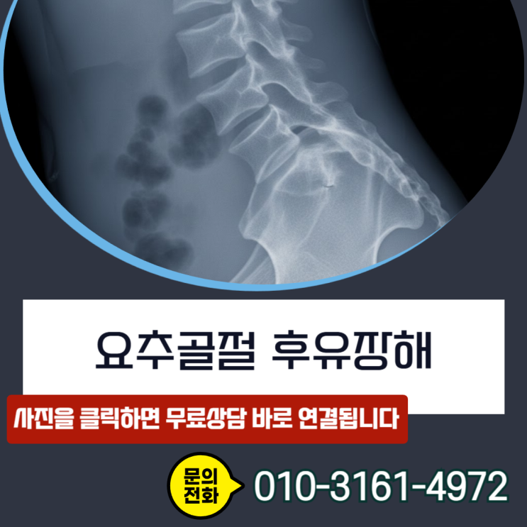  요추골절 후유장해 청구, 진단비만받았다면 이미 손해를 보고 있습니다