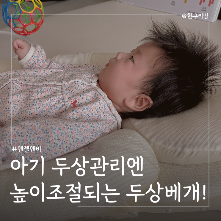  신생아 두상관리 언제부터 엔젤앤비 높이조절 두상배게 사용기