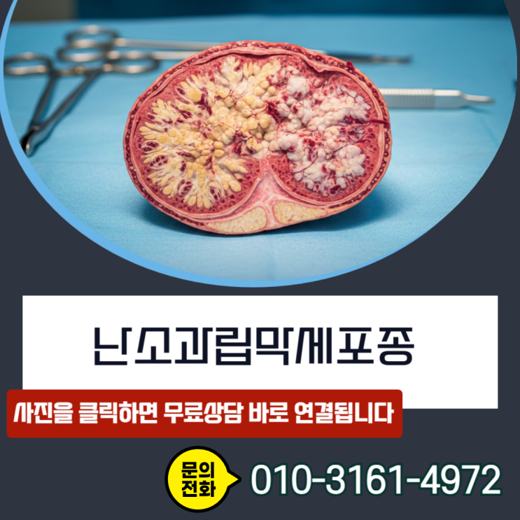  난소과립막세포종 암보험금, D39.1 코드라도 100% 전액 수령하는 핵심 비결