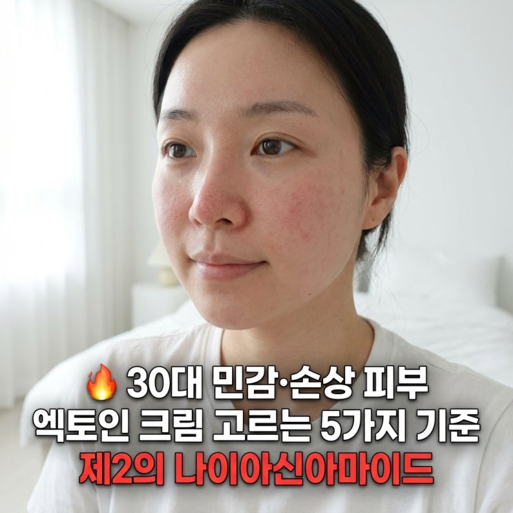   30대 민감·손상 피부 엑토인 크림 고르는 5가지 기준 | 제2의 나이아신아마이드