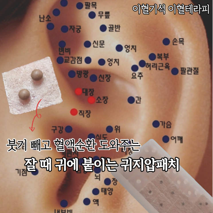  잘 때 귀에 붙이는 꿀템 이혈기석 귀지압패치 후기 (+귀혈자리 지압점 위치)