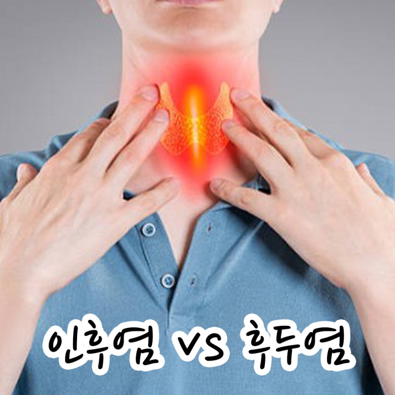 인후염과 후두염 증상별 차이 해결법 총정리