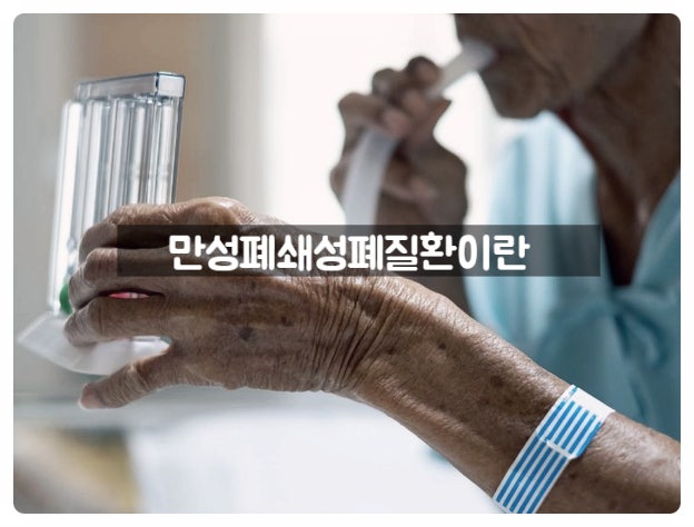 숨이 차다면 의심해 볼 만성폐쇄성폐질환에 대한 모든 것