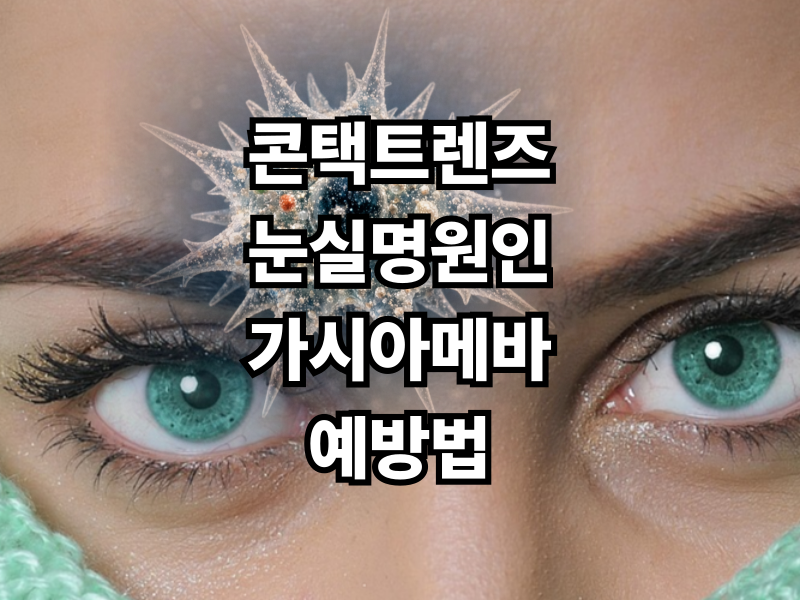 콘택트렌즈 잘못 사용하면 실명까지? 가시아메바 각막염 원인과 예방법 총정리