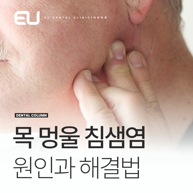 목 아플때 멍울 만져지면 침샘염일까?