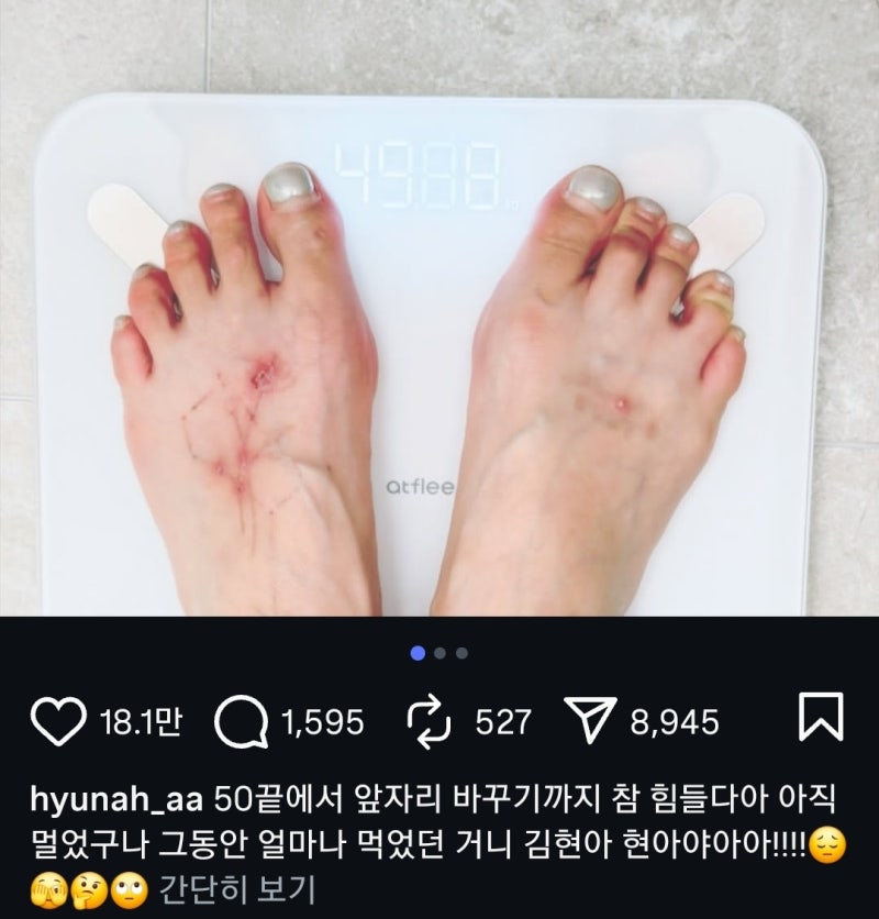 “현아♥용준형, 결혼 후 뭐가 달라졌나”…프로필·가족관계·신혼 근황까지 한눈에