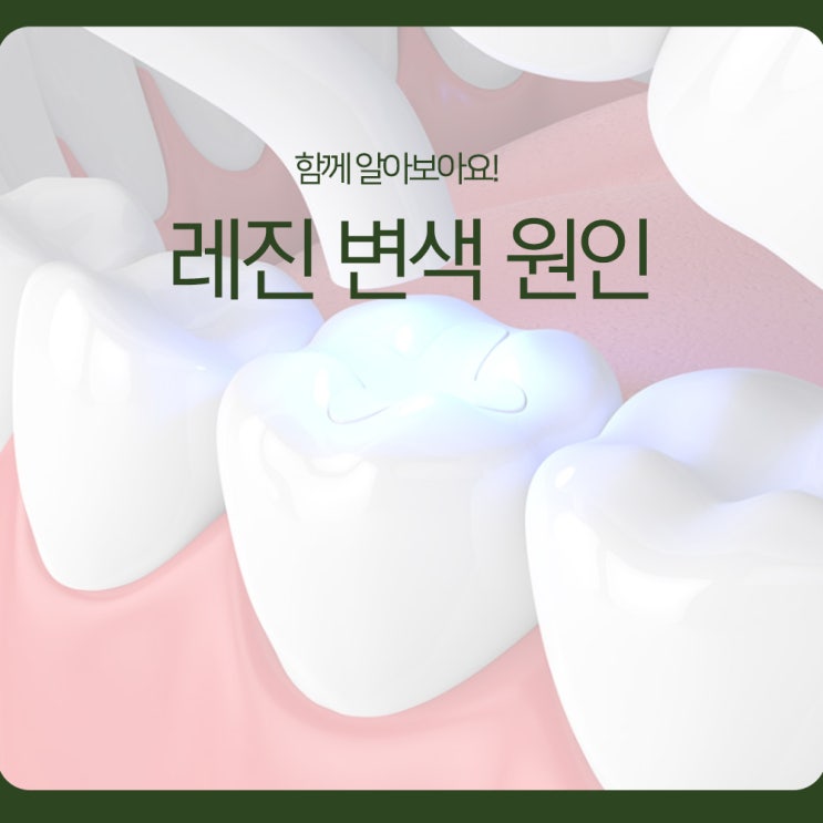 레진 변색 원인, 함께 알아보아요!