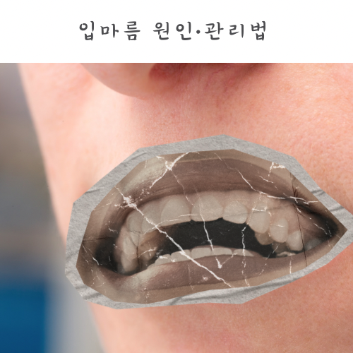 입마름 원인 당뇨 갱년기 연관성 입이 자주 마를때 관리법