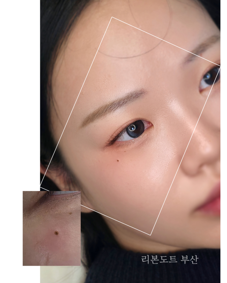  부산 미인점타투 시술, 번짐 없이 자연스러운 매력 점타투 찾기 (위치/유지기간/비용)