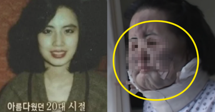  선풍기 아줌마’ 한혜경, 50대의 나이로 사망… 꼬꼬무가 밝힌 불법 성형의 전말과 그 이후 이야기 (+성형 전·근황·식용유·공업용 실리콘)