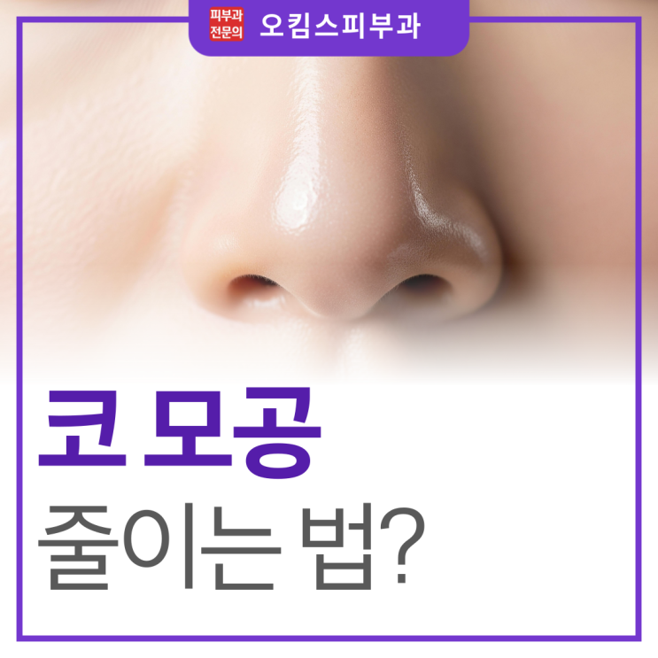 일산 바이폴라 고주파 지저분한 코모공 줄이는법, 어떻게 관리할까?