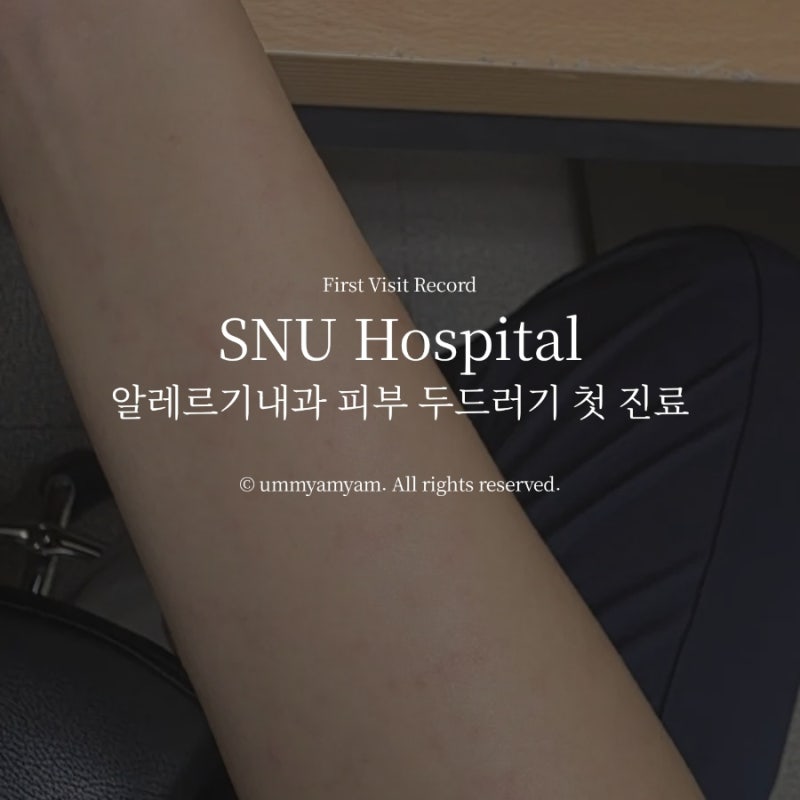 서울대병원 외래 첫 진료 / 알레르기내과 (피부 두드러기)