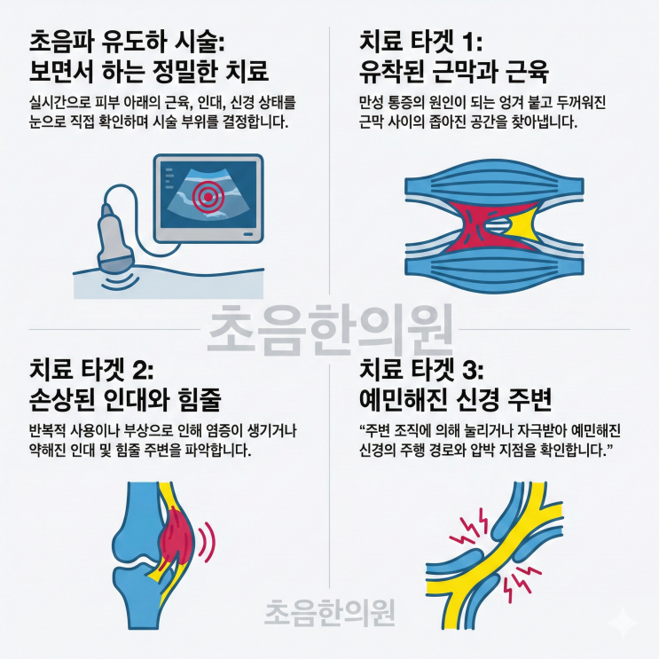  초음한의원 치료법 Hydrorelease 소개
