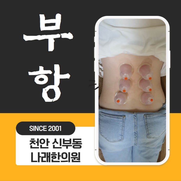 한의원 부항의 종류와 시술 비용 천안 신부동