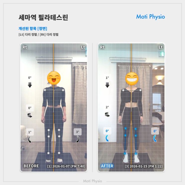  메뉴얼 테라피란 무엇인가요?
