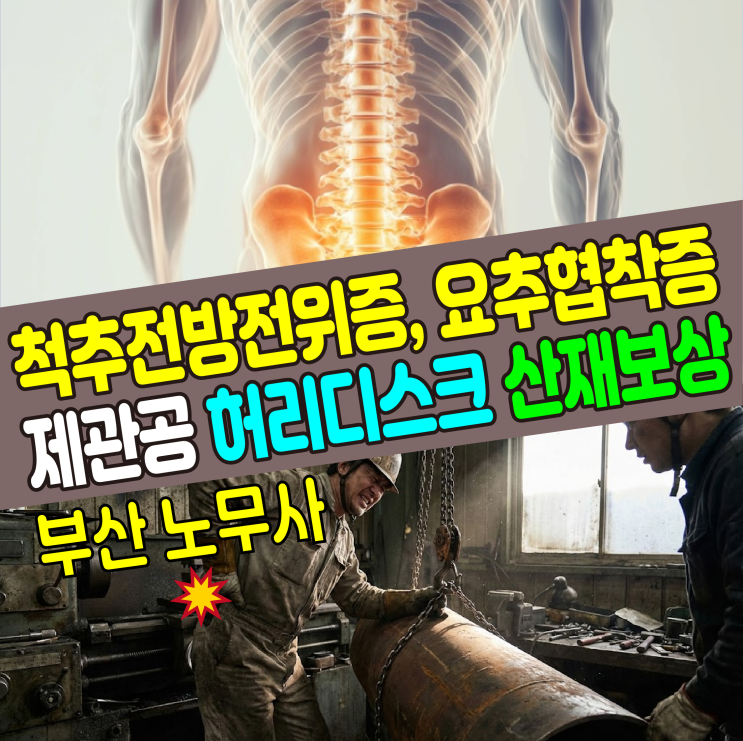  [부산 노무사] 척추전방전위증 요추협착증, 허리디스크 산재 보상사례(제관공)