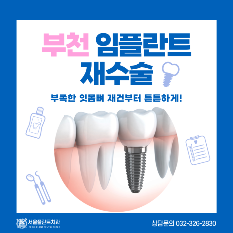  부천 임플란트 재수술 부족한 잇몸뼈 재건부터 튼튼하게