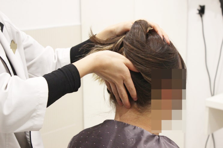  원주두피관리 비듬 제거와 건강한 두피 만들기