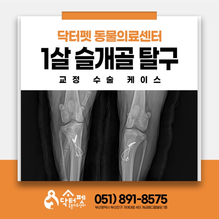  1살 강아지가 다리를 절고 떨어요! 수술 결정에서 긴 회복기간까지 양측 슬개골 탈구