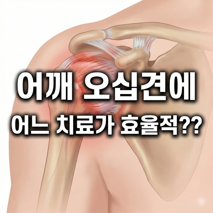  정자역 한의원 오십견 주사, 침 치료 어떤 차이가 있나?