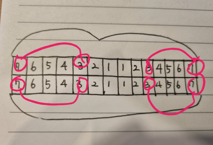 돌출입교정후기 4개월에서 10개월차! 어떻게 변했을까요!?