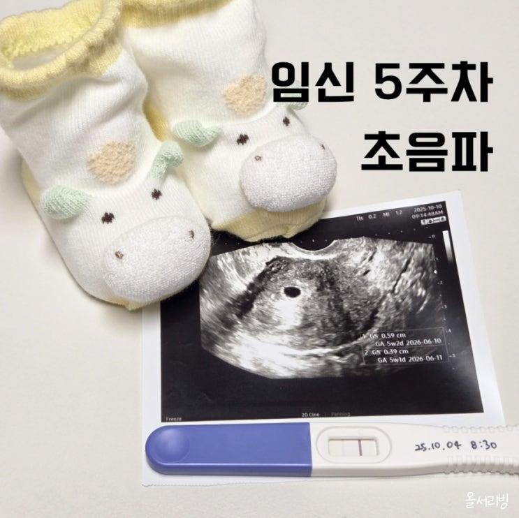  임신 5주차 초음파 아기집에 난황이 안 보여요