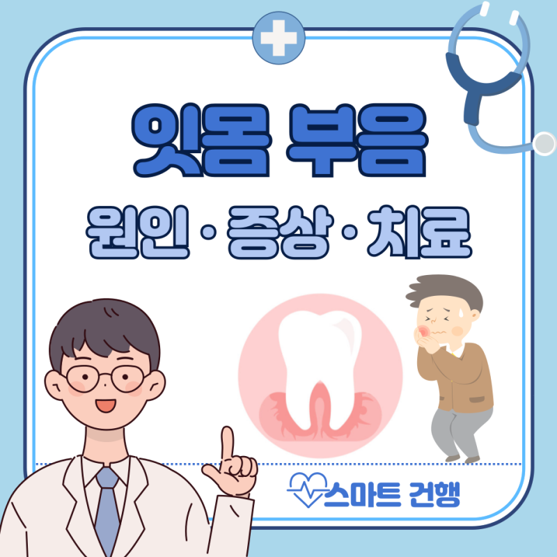 어금니 잇몸 부음 원인, 잇몸이 부었을때 대처법 : 약국 약