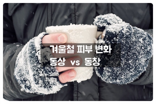 차가운 공기에 노출되어 피부 가려울 때 동창과 동상증상은 달라요