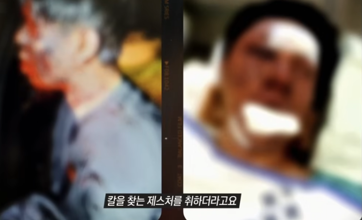   납치·폭행 피해 100만 유튜버 ‘수탉’ 근황 공개…유튜브 복귀에 쏠린 시선 “차츰 나아지고 있다”…그가 다시 카메라 앞에 선 이유 ,그것이 알고싶다