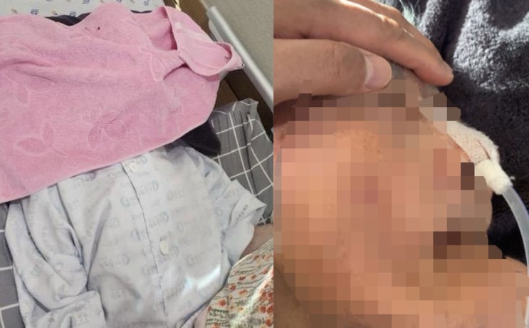 요양병원 어머니 얼굴에 수건이? 묶인 두 손과 방치된 인권, 무엇이 문제인가
