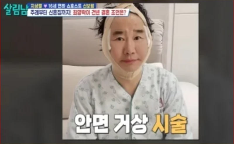 최양락 안면거상 모발이식 풀코스 성형 견적 지상렬 쌍수 권유 (프로필 나이)