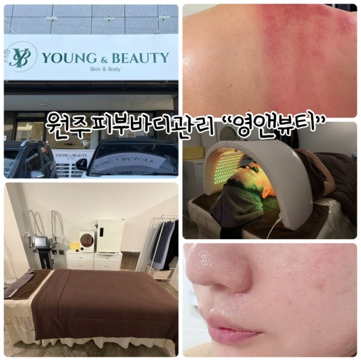  원주피부바디관리 "영앤뷰티" 토탈뷰티샵에서 관리받고온 후기