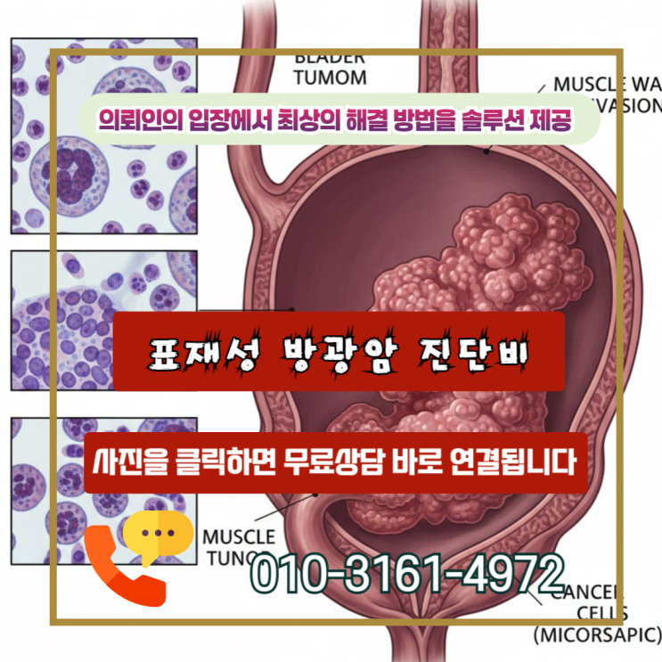  표재성 방광암 진단비, 보험사가 소액이라 우겨도 전액 받을 수 있는 이유