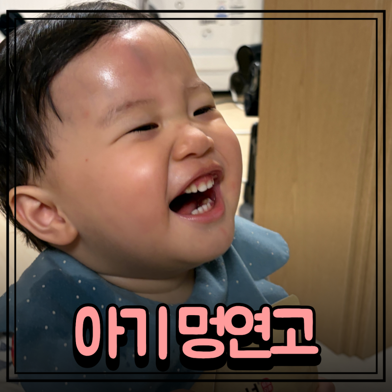 아기 멍연고 종류 사용시기 부작용 관리법