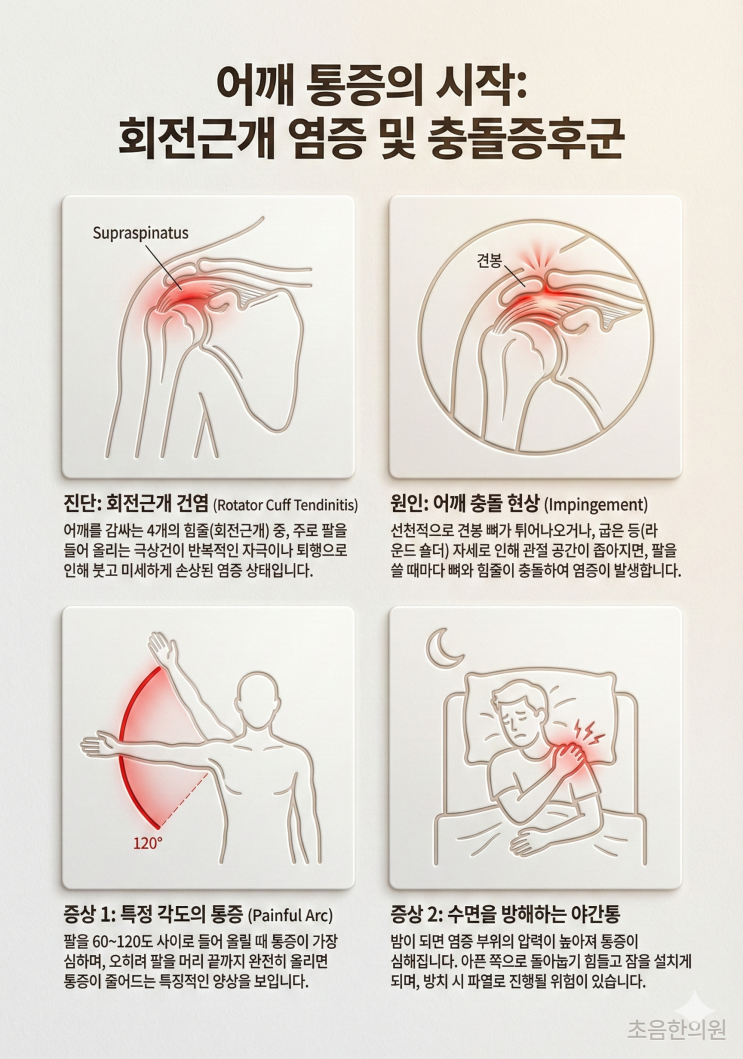  팔 들 때마다 뜨끔 밤잠 설치는 어깨 통증  (회전근개 염증 충돌 증후군)