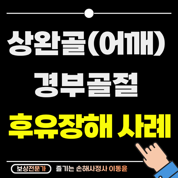  상완골 경부 골절, 수술 안 해도 후유장해 보상받은 사례